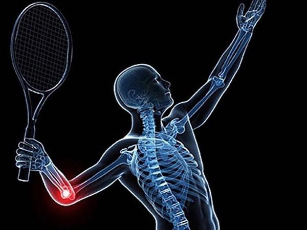 Traumatologia do esporte